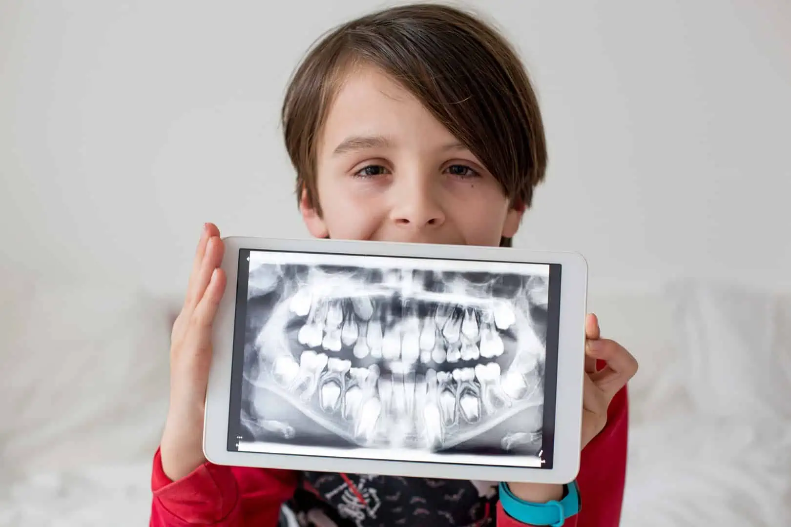 Digital X-ray of an infected tooth