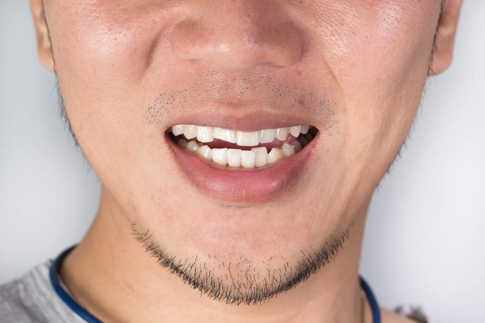 Range of dental emergencies treated